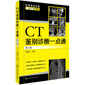 影像鉴别诊断一目了然系列--CT鉴别诊断一点通（第三版） 下载
