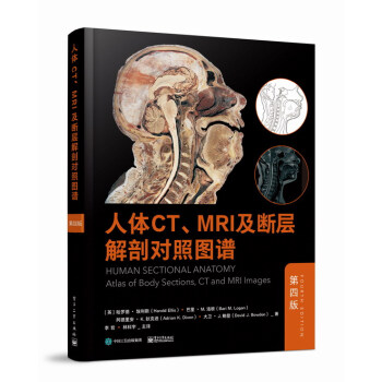 人体CT、MRI及断层解剖对照图谱（第四版） 下载