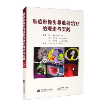 肺癌影像引导放射治疗的理论与实践 [Principles and Practice of Image-Guided Radiation Therapy of Lung Cancer]