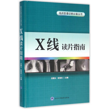 X线读片指南/临床影像诊断必备丛书