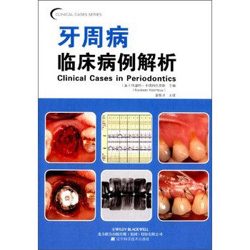 口腔临床病例解析丛书：牙周病临床病例解析 下载