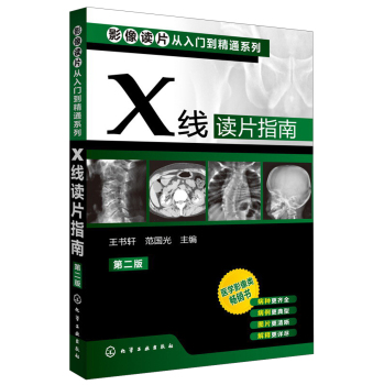 影像读片从入门到精通系列：X线读片指南