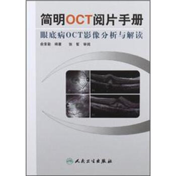 简明OCT阅片手册：眼底病OCT影像分析与解读   下载