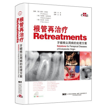 根管再治疗——牙髓根尖周病的处理方案 下载