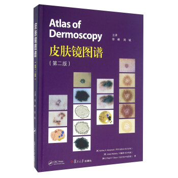 皮肤镜图谱（第二版） [Atlas Of Dermoscopy] 下载