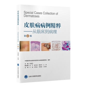 皮肤病病例精粹——从临床到病理（第2辑） [Special Cases Collection of Dermatoses] 下载