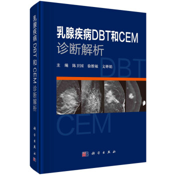 乳腺疾病DBT 和 CEM诊断解析 下载