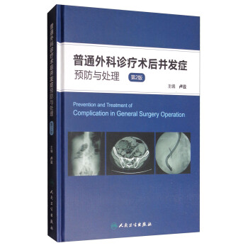 普通外科诊疗术后并发症预防与处理（第2版） [Prevention and Treatment of Complication in General Surgery Operation] 下载