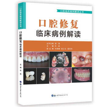 口腔修复临床病例解读/口腔临床病例解读丛书 下载