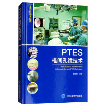 PTES椎间孔镜技术（附手术视频） [Percutaneous Transforaminal Endoscopic Surgery（PTES）Technique] 下载