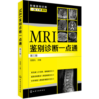 影像鉴别诊断一目了然系列--MRI鉴别诊断一点通（第三版）