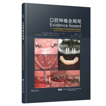 口腔种植全局观——全身疾病患者口腔种植的循证医学指南