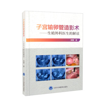 子宫输卵管造影术：生殖外科医生的解读 下载