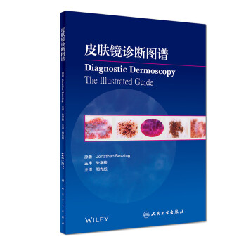 皮肤镜诊断图谱（翻译版） [Diagnostic dermoscopy the illustrated Guide] 下载