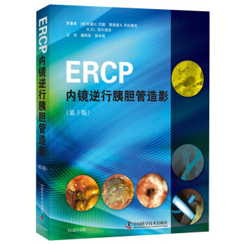 ERCP内镜逆行胰胆管造影
