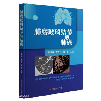 肺磨玻璃结节与肺癌 关于肺结节和肺癌，你应该知道的医学知识 下载