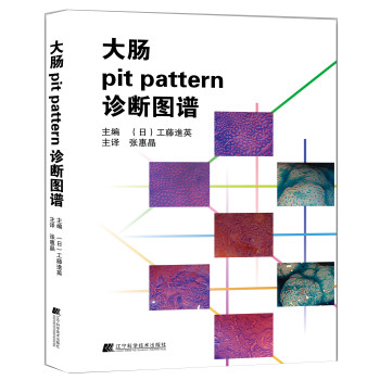 大肠pit pattern诊断图谱 下载